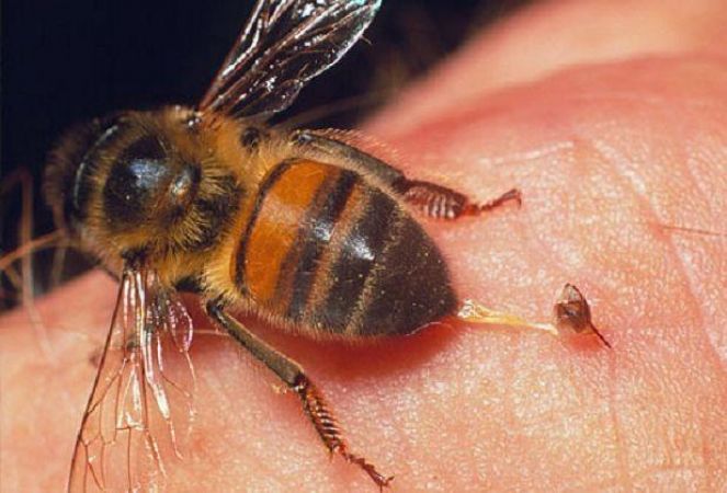 क्या करे जब मधुमक्खी काट ले तो