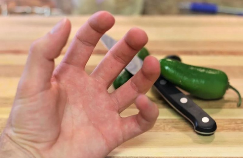 Get Rid of Burning Sensation in Hands After Cutting Chillies with These Tricks
