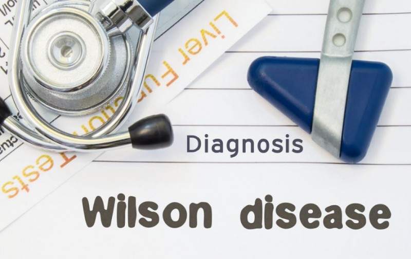 What is Wilson's Disease? Learn What to Eat and What to Avoid During This Time