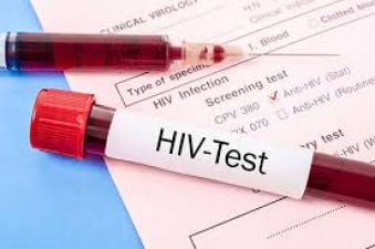 इन लक्षण से जानें कहीं आपको HIV तो नहीं...