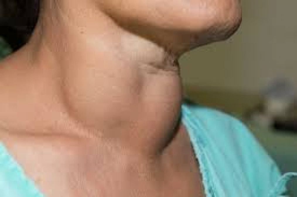 Thyroid patients should not eat these things, know its symptoms and treatment