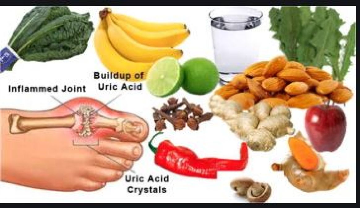 These diseases can occur due to an increase in uric acid, can be controlled in this way!