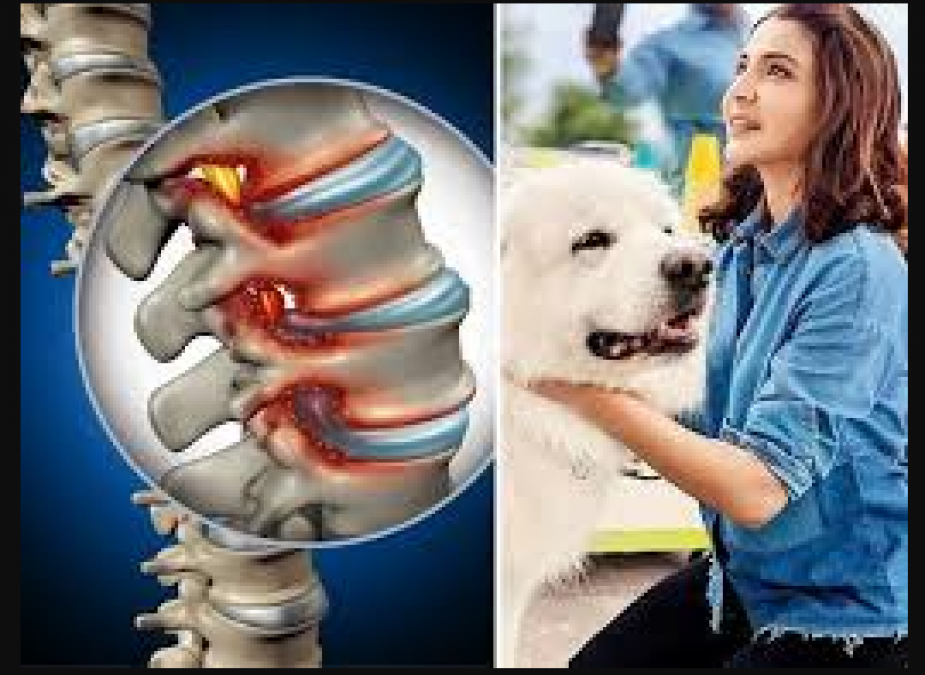 Do you know about the problem of bulging disc, actress Anushka Sharma is also a victim of it