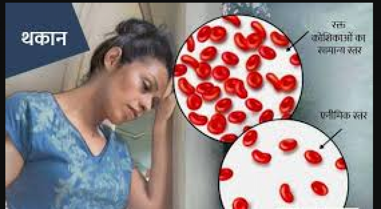 Health tips for Anemia patients, know what you should eat and what not