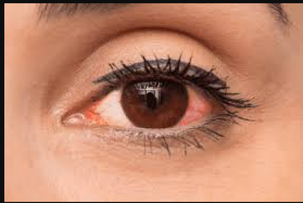 For these reasons, there is swelling in the eyes, know more