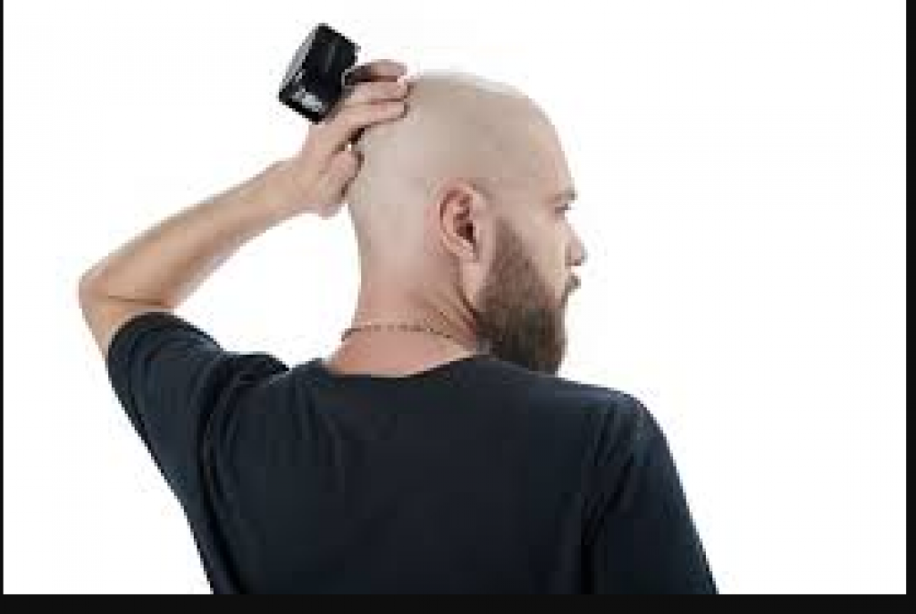 These are the reason for baldness in men