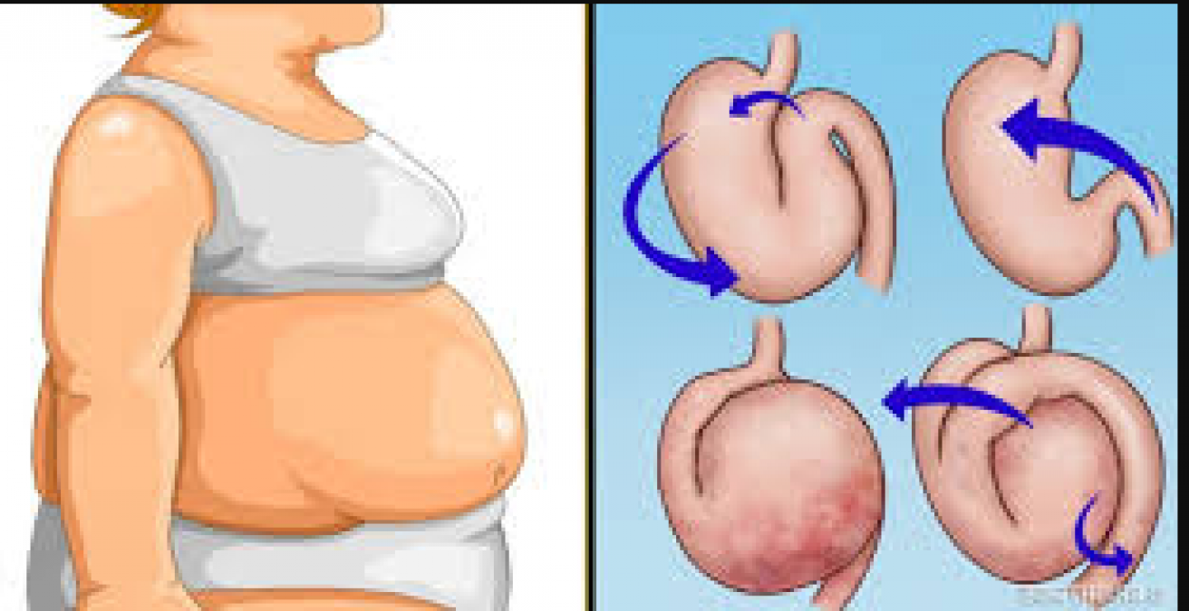 If you want to get rid of stomach gas then make this necessary change