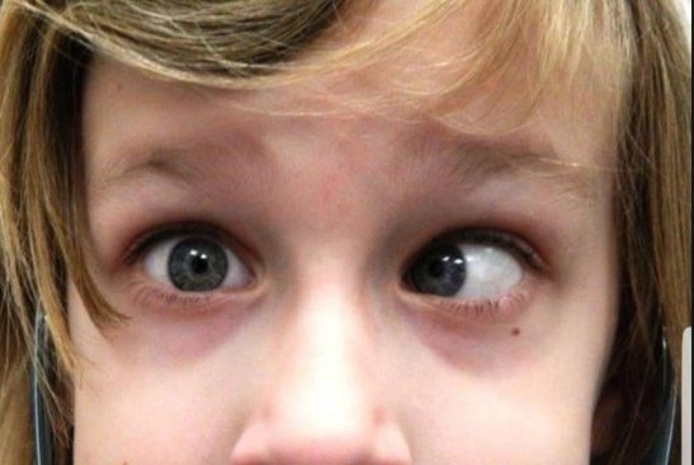 Keep smartphones away from children, otherwise, they will lose their eyesight