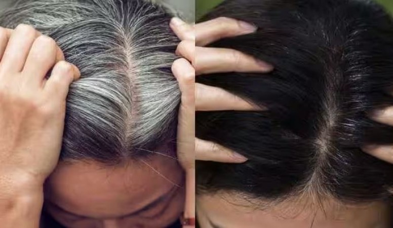 Hair Will Turn from White to Black in Just 7 Days with This One Daily Practice