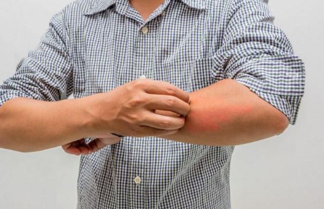 Avoid skin infections like this during the rainy season