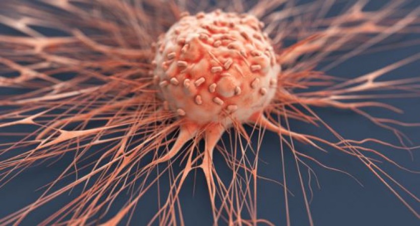शरीर में गांठ हो सकती है लिम्फोमा कैंसर, जानिए इसके लक्षण