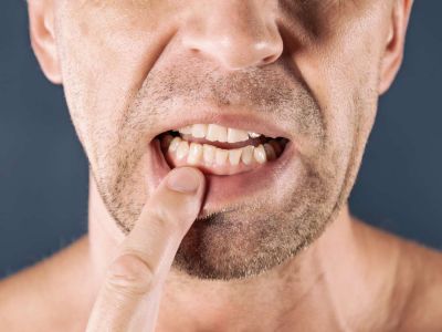Poor oral health may lead to many diseases, know symptoms