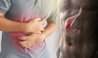 Know What are the Symptoms and Signs of Stomach Cancer