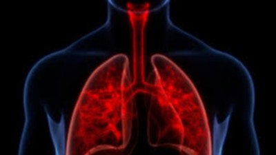 What is COPD?