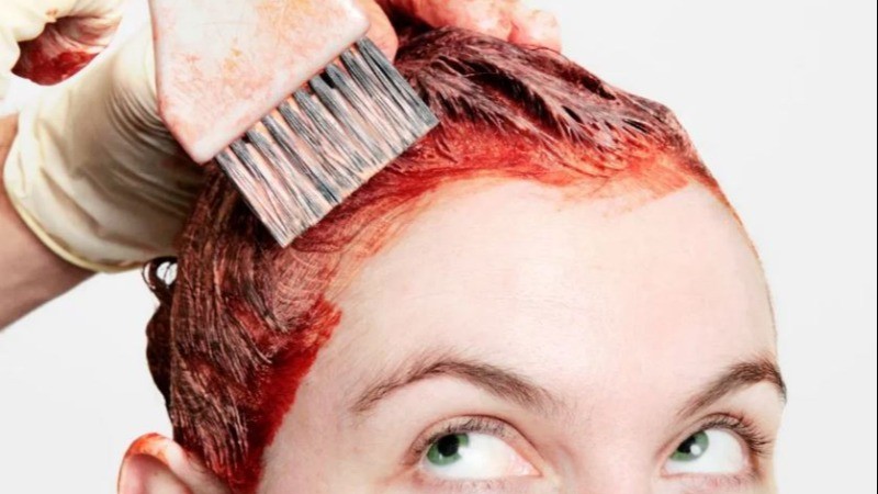 Woman loses eye due to hair dye