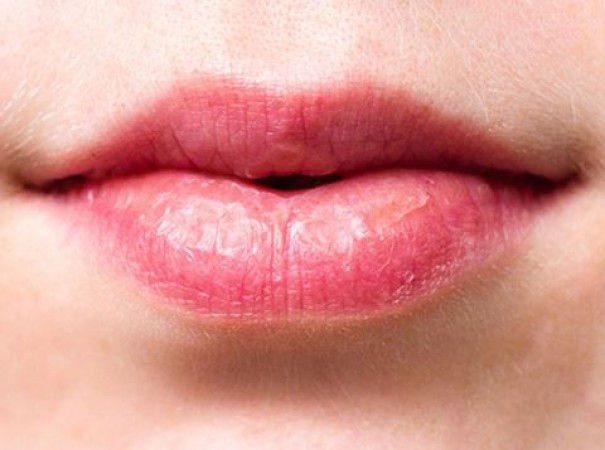 Don't Ignore Lip and Eye Changes, These Symptoms Could Indicate Diseases