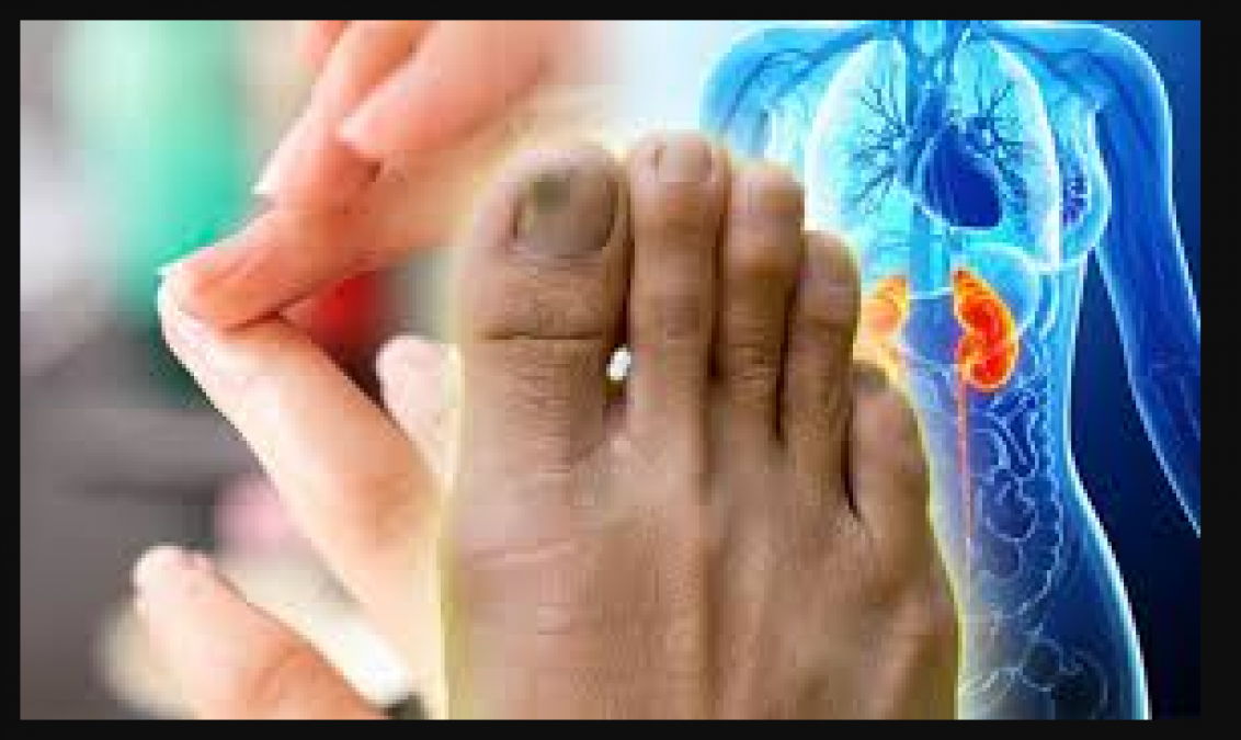 Secret of health is hidden in the nails, know what it indicates