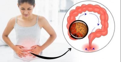 These symptoms are seen when there are worms in the stomach, follow these home remedies to eliminate