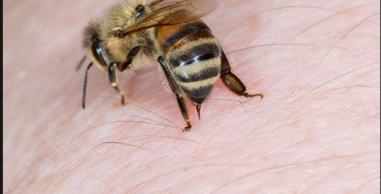 If a bee bites then do not panic, but follow these home remedies