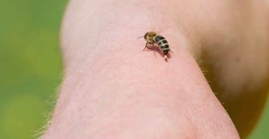If a bee bites then do not panic, but follow these home remedies