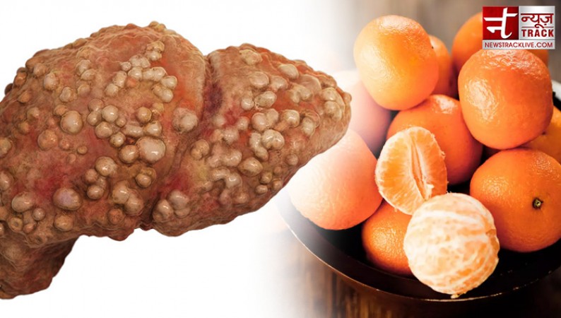 Rash in the stomach is a symptom of liver cancer, avoid eating these things