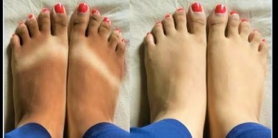 Apply these 3 things to remove tanning from feet