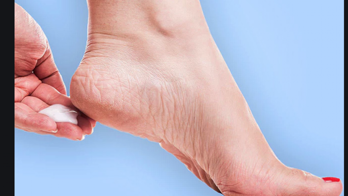 These home remedies will fix cracked heels