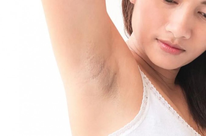 How to Banish Dark Underarms? Tried and Tested Remedies