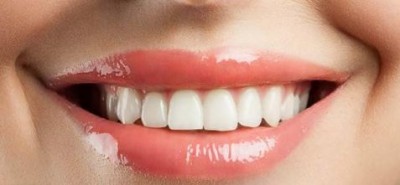 Try these home remedies to whiten teeth
