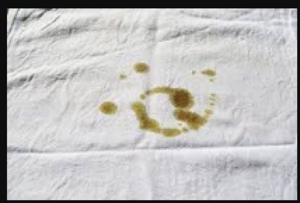 These home remedies are useful in removing stains