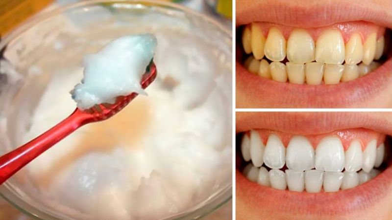 दांतों को झट सफ़ेद बनाएंगे ये उपाय