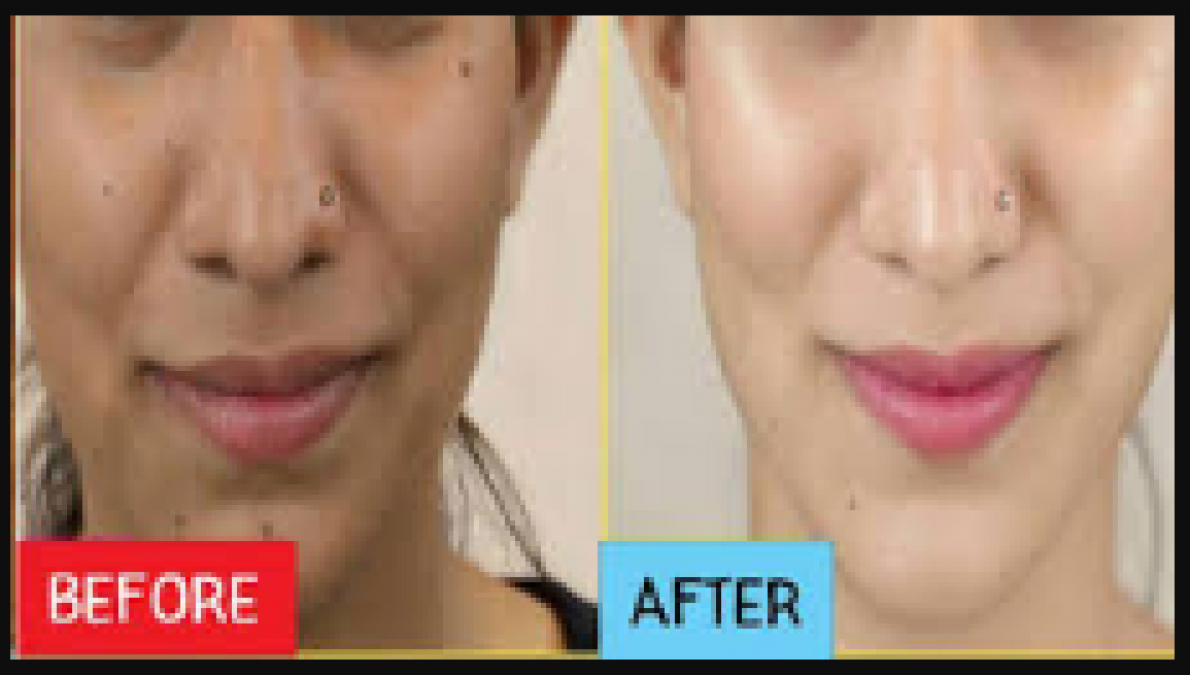 Follow these effective steps to get skin brightening and lightening effects at home