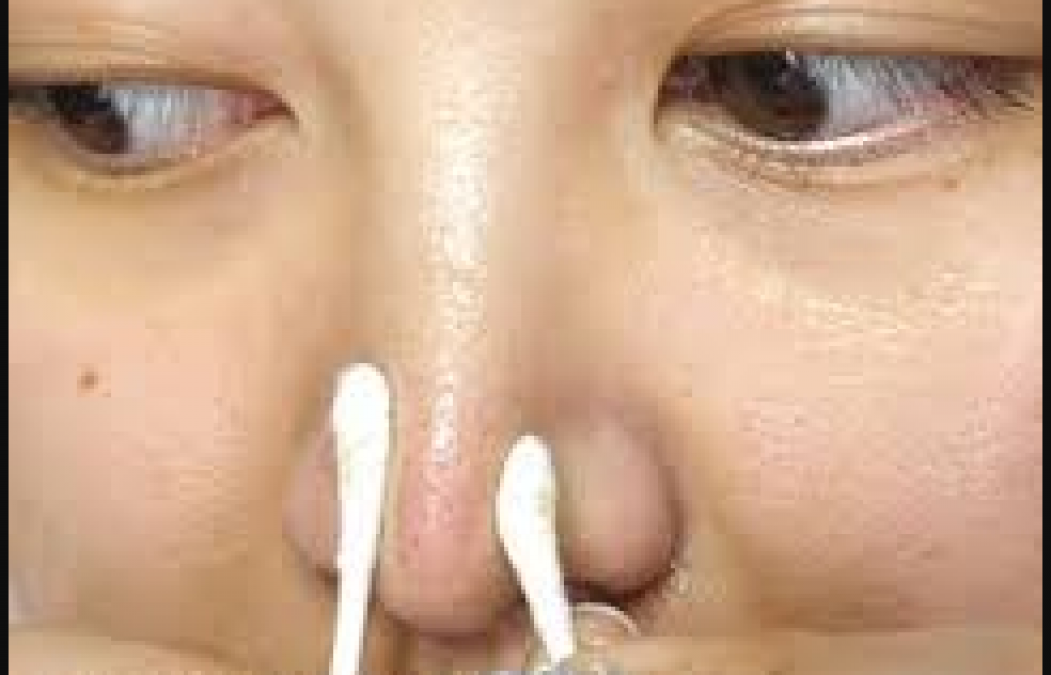 This solution will remove blackheads in the domestic way