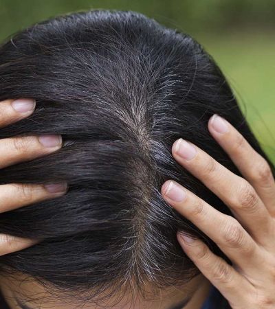 ये 5 नुस्खे करेंगे आपके सफ़ेद बालों का इलाज
