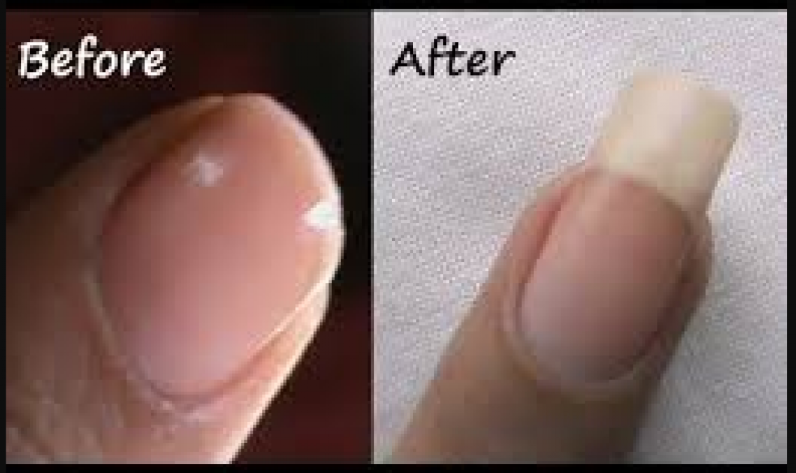 Follow these steps to get long nails soon, know here