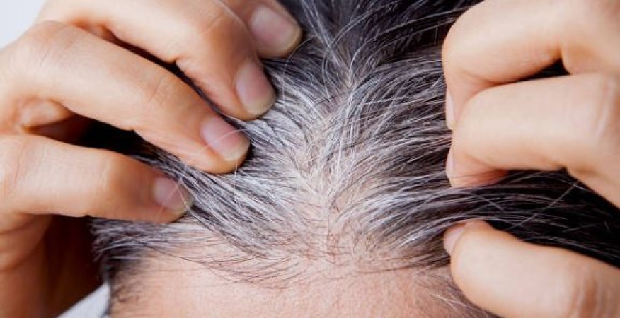 Troubled by greying of hair, then follow these 8 home remedies