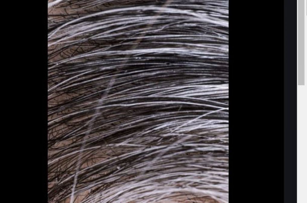 Troubled by greying of hair, then follow these 8 home remedies