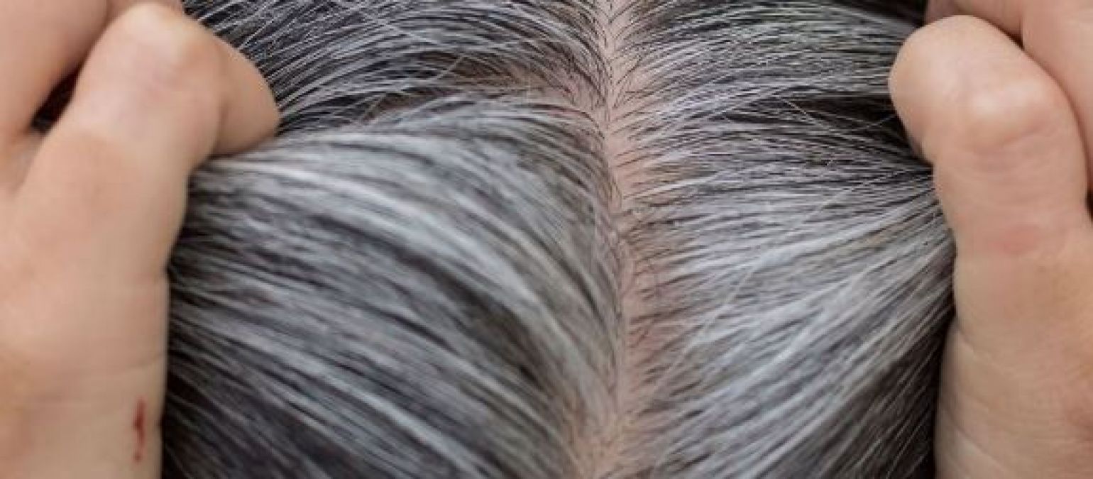 Troubled by greying of hair, then follow these 8 home remedies