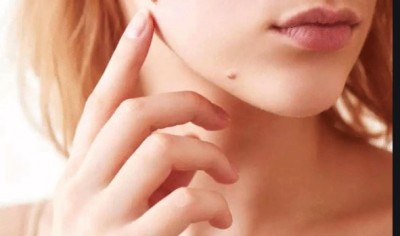 Want to remove unwanted warts from body overnight, then follow these home remedies