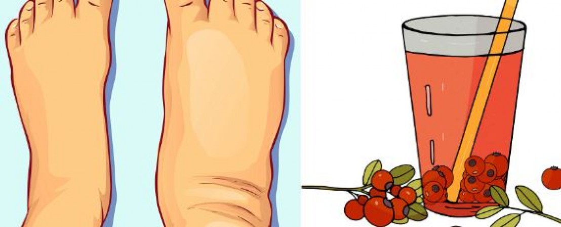 Troubled by swelling in the body, then use these home remedies