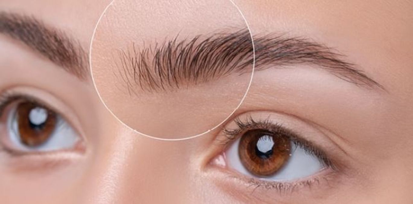 Dandruff has happened on the eyebrows, so adopt these home remedies