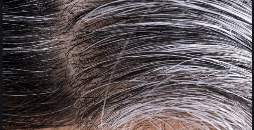 From gourd to coconut oil, turn white hairs black with these home remedies