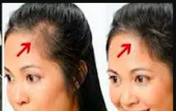 Problem of hair fall increases in winter, know how to get rid of it