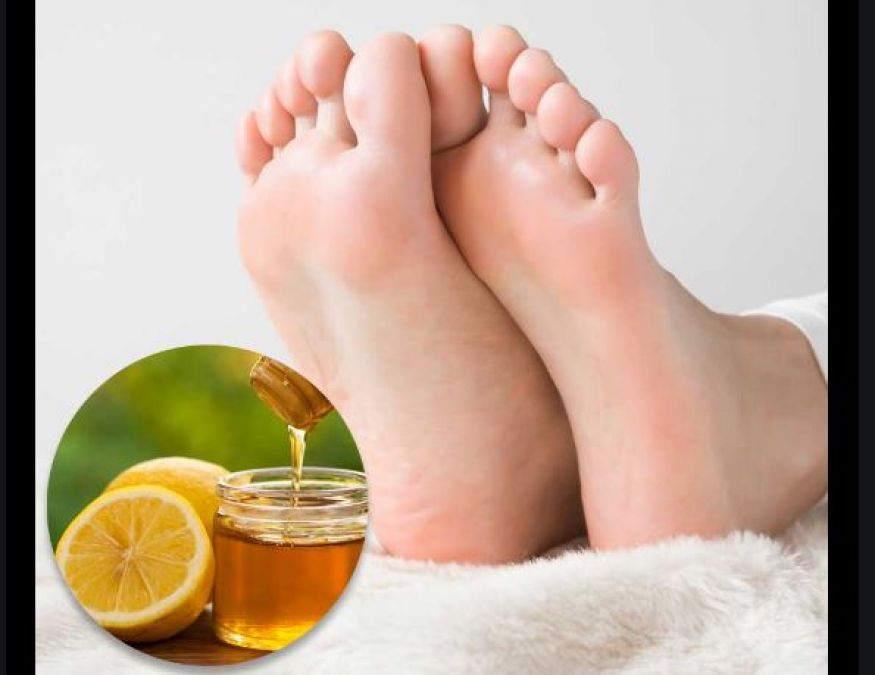 If you are upset with cracked heels, use this home remedies