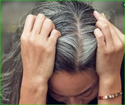 If you are troubled by white hair, follow these home tips