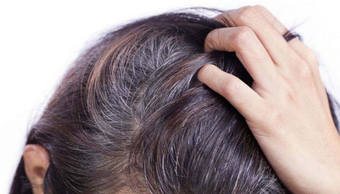 White hair at an early age is troublesome so do adopt these traditional methods!