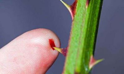 Thorn pricking can give you infection, Know home remedies to treat it effectively