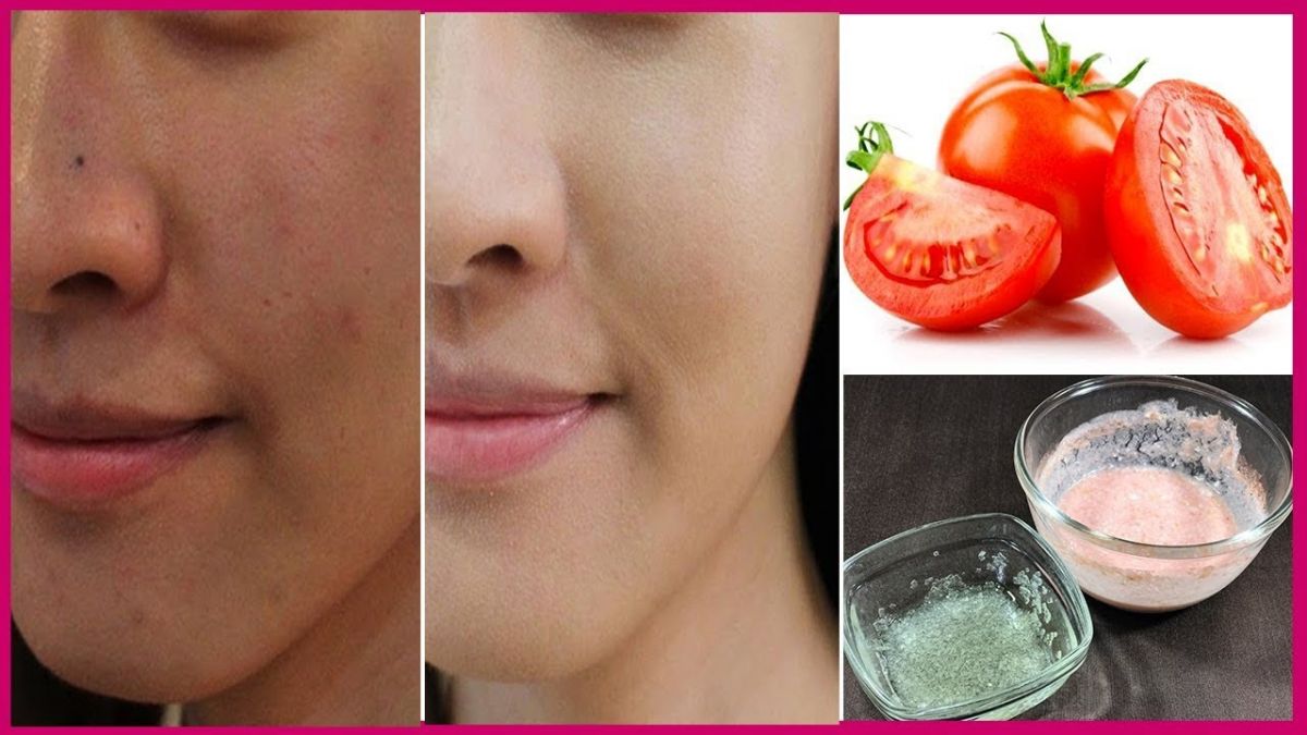 Get rid of Suntanin just in 7 days with these home remedies