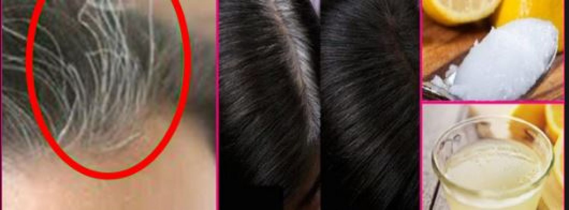 These home remedies will make whiteness of hair disappear in a month