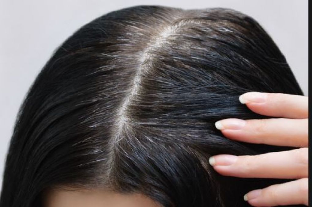 These home remedies will make whiteness of hair disappear in a month